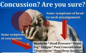 concussion neck misalignment e1537120186956
