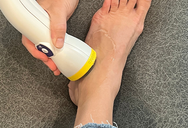 softwave treatment of foot